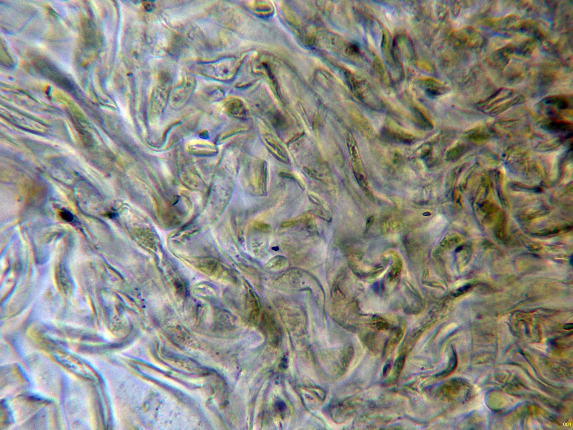 Microscopía de Rubroboletus rubrosanguineus - 10 - Suprapellis agua-001